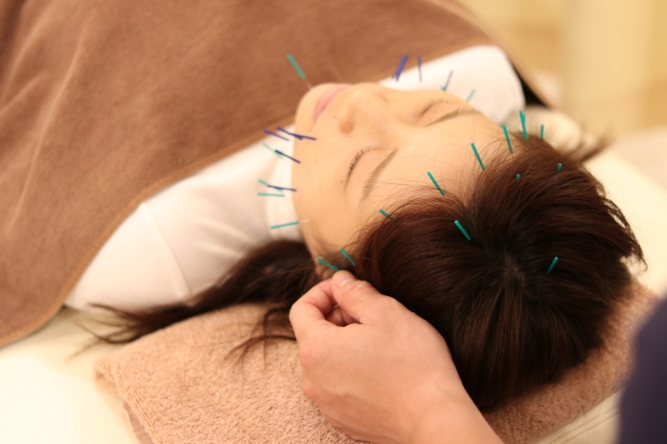 プラチナ美容鍼